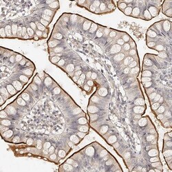 ZNF789 Antibody, Novus Biologicals 0.1mL; Unlabeled:Antibodies, Polyclonal