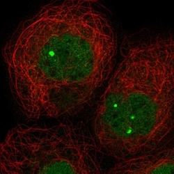 ZNF8 Antibody, Novus Biologicals 25 &mu;L; Unlabeled:Antibodies, Polyclonal