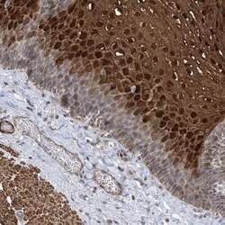 ZNF8 Antibody, Novus Biologicals 25 &mu;L; Unlabeled:Antibodies, Polyclonal