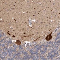 ZNF804B Antibody, Novus Biologicals:Antibodies:Primary Antibodies