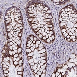 ZNF813 Antibody, Novus Biologicals:Antibodies:Primary Antibodies