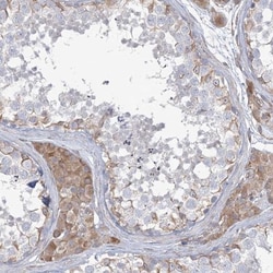 ZNF821 Antibody, Novus Biologicals 25 &mu;L; Unlabeled:Antibodies, Polyclonal
