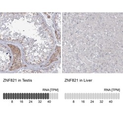 ZNF821 Antibody, Novus Biologicals 25 &mu;L; Unlabeled:Antibodies, Polyclonal