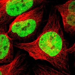 ZNF828 Antibody, Novus Biologicals 25 &mu;L; Unlabeled:Antibodies, Polyclonal