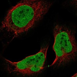 ZNF828 Antibody, Novus Biologicals 25 &mu;L; Unlabeled:Antibodies, Polyclonal