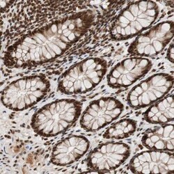 ZNF828 Antibody, Novus Biologicals 25 &mu;L; Unlabeled:Antibodies, Polyclonal