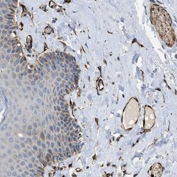 ZNF831 Antibody, Novus Biologicals 25 &mu;L; Unlabeled:Antibodies, Polyclonal