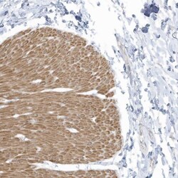 ZNF846 Antibody, Novus Biologicals:Antibodies:Primary Antibodies