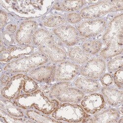ZNF852 Antibody, Novus Biologicals:Antibodies:Primary Antibodies