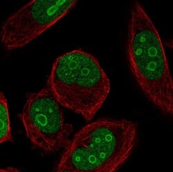ZNF860 Antibody, Novus Biologicals:Antibodies:Primary Antibodies
