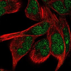 ZNF878 Antibody, Novus Biologicals 0.1mL; Unlabeled:Antibodies, Polyclonal