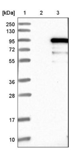 ZNF96 Antibody, Novus Biologicals 0.1mL; Unlabeled:Antibodies, Polyclonal