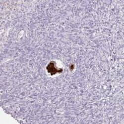 ZP3 Antibody, Novus Biologicals:Antibodies:Primary Antibodies