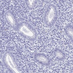 ZPBP Antibody, Novus Biologicals 0.1mL; Unlabeled:Antibodies, Polyclonal