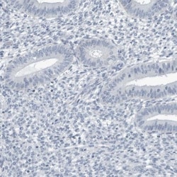 ZPBP2 Antibody, Novus Biologicals 0.1mL; Unlabeled:Antibodies, Polyclonal