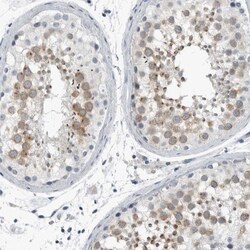 ZPBP2 Antibody, Novus Biologicals 0.1mL; Unlabeled:Antibodies, Polyclonal