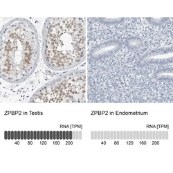 ZPBP2 Antibody, Novus Biologicals 0.1mL; Unlabeled:Antibodies, Polyclonal