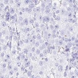 ZPBP2 Antibody, Novus Biologicals 25 &mu;L, Unlabeled:Antibodies, Polyclonal