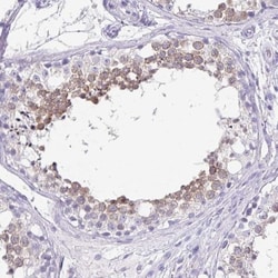 ZPBP2 Antibody, Novus Biologicals 25 &mu;L, Unlabeled:Antibodies, Polyclonal