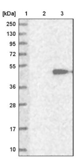 ZPBP2 Antibody, Novus Biologicals 0.1mL; Unlabeled:Antibodies, Polyclonal