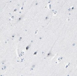 ZSCAN1 Antibody, Novus Biologicals:Antibodies:Primary Antibodies