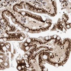 ZSCAN2 Antibody, Novus Biologicals:Antibodies:Primary Antibodies