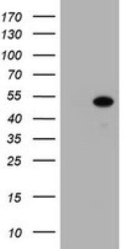 ZSCAN4 Antibody (OTI1A6), Novus Biologicals 0.1mL; Unlabeled:Antibodies,