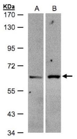 ZSCAN5 Antibody, Novus Biologicals 0.1mg; Unlabeled:Antibodies, Polyclonal