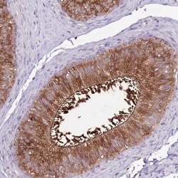 ZSWIM1 Antibody, Novus Biologicals 25 &mu;L, Unlabeled:Antibodies, Polyclonal
