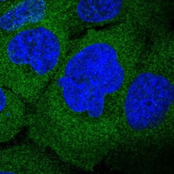 ZW10 Antibody, Novus Biologicals 0.1mL; Unlabeled:Antibodies, Polyclonal
