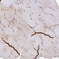 ZW10 Antibody, Novus Biologicals:Antibodies:Primary Antibodies