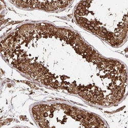 ZW10 Antibody, Novus Biologicals:Antibodies:Primary Antibodies
