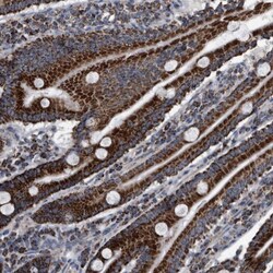 ZWINT Antibody, Novus Biologicals 0.1 mL | Buy Online | Novus Biologicals | Fisher Scientific