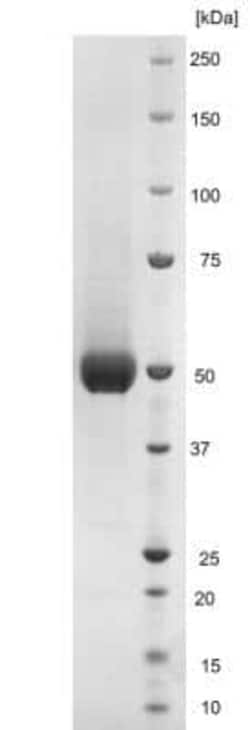 Novus Biologicals Recombinant Virus Zika Virus Envelope Suriname Z1106033 His (C-Term) Protein 0.5 mg | Buy Online | Novus Biologicals | Fisher Scientific