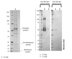 Novus Biologicals Recombinant Virus Zika Virus VLP Suriname Z1106033 Protein 0.1 mg | Buy Online | Novus Biologicals | Fisher Scientific