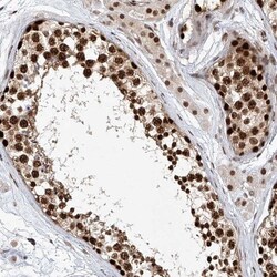 Zinc finger protein 470 Antibody, Novus Biologicals 0.1mL; Unlabeled:Antibodies,