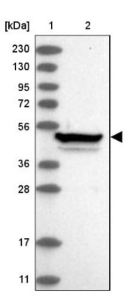 Zinc finger protein 774 Antibody, Novus Biologicals:Antibodies:Primary