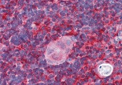 actin-related protein 2/3 complex subunit 1B Antibody, Novus Biologicals