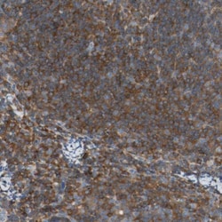 actin-related protein 2/3 complex subunit 1B Antibody, Novus Biologicals