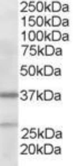 actin-related protein 2/3 complex subunit 1B Antibody, Novus Biologicals