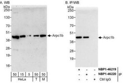 actin-related protein 2/3 complex subunit 1B Antibody, Novus Biologicals