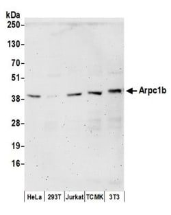 actin-related protein 2/3 complex subunit 1B Antibody, Novus Biologicals