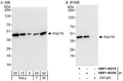 actin-related protein 2/3 complex subunit 1B Antibody, Novus Biologicals 0.1 mL | Buy Online | Novus Biologicals | Fisher Scientific