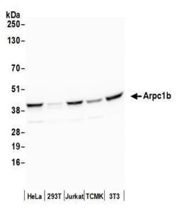 actin-related protein 2/3 complex subunit 1B Antibody, Novus Biologicals 0.1 mL | Buy Online | Novus Biologicals | Fisher Scientific