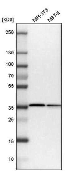 actin-related protein 2/3 complex subunit 1B Antibody, Novus Biologicals