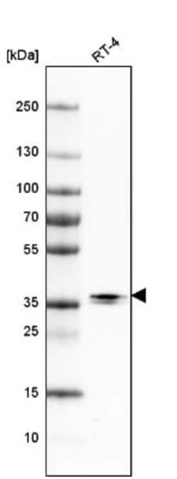actin-related protein 2/3 complex subunit 1B Antibody, Novus Biologicals