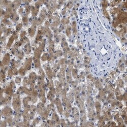 alcohol dehydrogenase 4 Antibody, Novus Biologicals:Antibodies:Primary