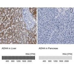 alcohol dehydrogenase 4 Antibody, Novus Biologicals:Antibodies:Primary