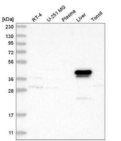 alcohol dehydrogenase 4 Antibody, Novus Biologicals:Antibodies:Primary