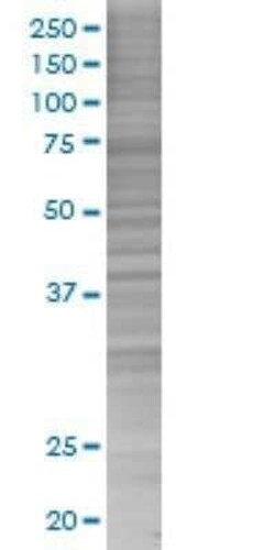 Novus Biologicals alcohol dehydrogenase 4 293T Cell Transient Overexpression Lysate 0.1 mL | Buy Online | Novus Biologicals&trade; | Fisher Scientific